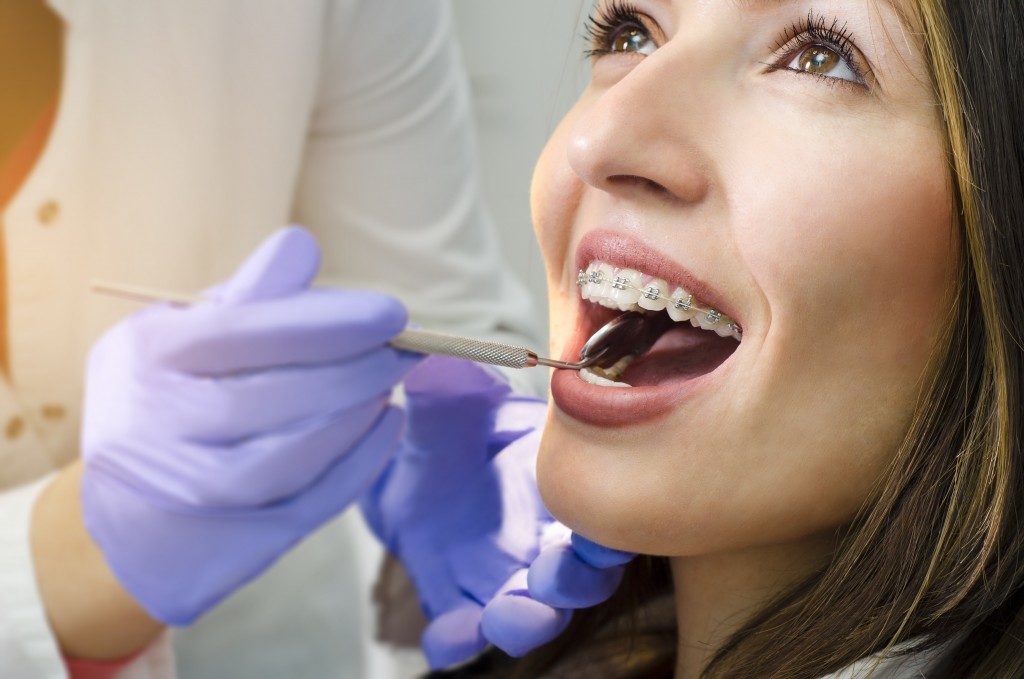 Closeup of girl on dental braces check up