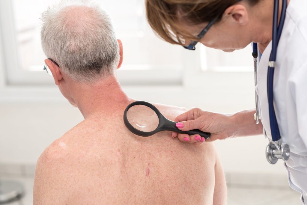 doctor inspecting the skin of a man